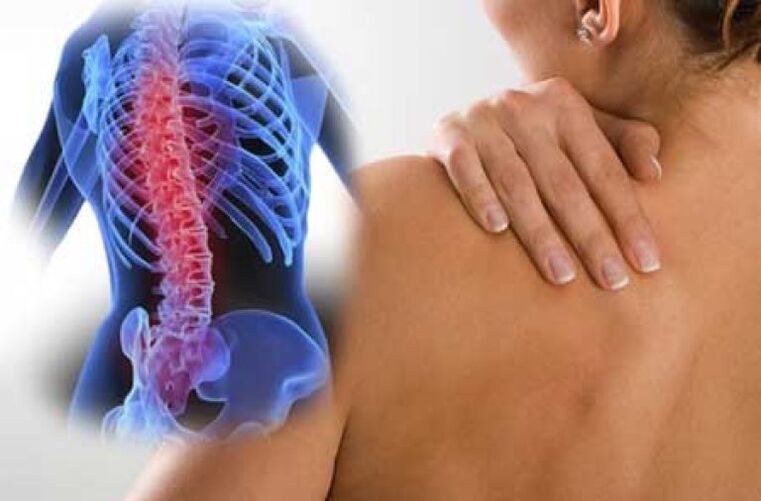 During an exacerbation of osteochondrosis of the thoracic spine, back pain occurs