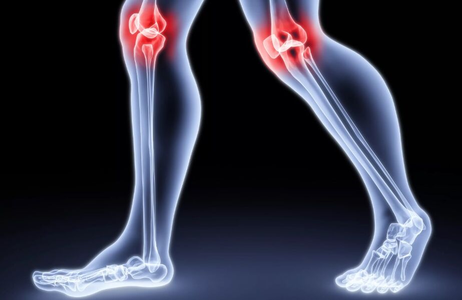 Joint pain