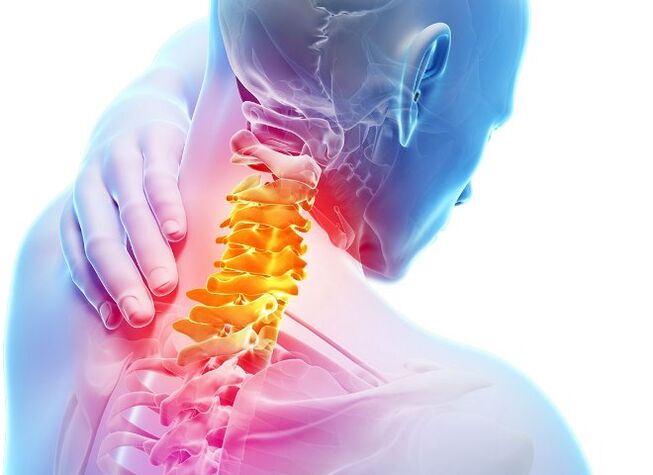 Symptoms and phases of the development of cervical osteochondosis
