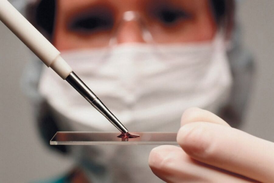 Arthritis is an inflammatory disease and its presence is revealed by blood tests.